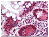 AP08374PU-N - PCNA
