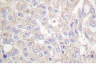 AP06093PU-N - CD324 / Cadherin-1