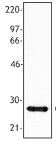 AP08403PU-N - C-reactive protein (CRP)