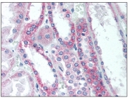 AP08404PU-N - EIF2A