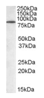 AP16111PU-N - TRIM3 / BERP