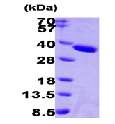 AR09273PU-L - Esterase D (ESD)