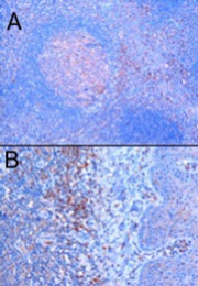 AP16125PU-N - TRIM5 / RNF88