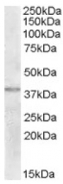 AP16771PU-N - TXNDC6 / TXL2