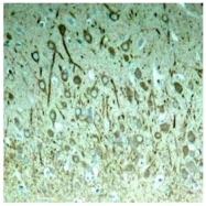 AP02402PU-S - MAPT / TAU