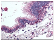 AP08440PU-N - HDAC4