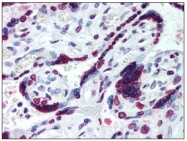 AP08444PU-N - HMGA1 / HMGIY