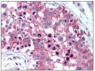 AP08451PU-N - IL20RA