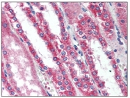 AP08472PU-N - TMEM123 / Porimin