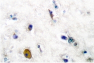 AP06128PU-N - GABBR1