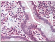 AP08494PU-N - BUB1A