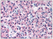 AP08504PU-N - Parathyroid hormone / PTH