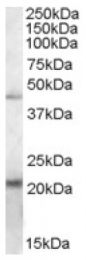 AP16785PU-N - TXNDC4 / ERP44