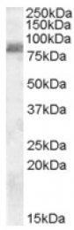 AP16809PU-N - ZRANB1