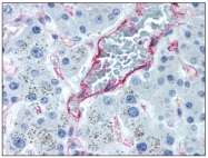 AP08512PU-N - CD105 / Endoglin