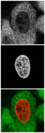 AP16197PU-N - KPNA2 / Importin alpha-2