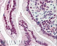 AP16199PU-N - KPNA4 / Importin alpha-4