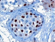 AP16199PU-N - KPNA4 / Importin alpha-4