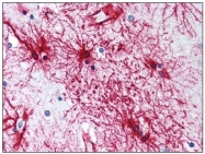AP08522PU-N - GFAP
