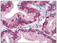 AP08527PU-N - EGFR / ERBB1
