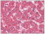 AP08533PU-N - XDH