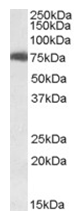 AP16213PU-N - USH1C / Harmonin