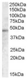 AP16704PU-N - TMPRSS3