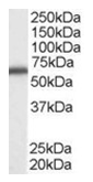 AP16219PU-N - DDX5
