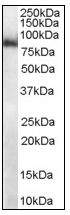AP08553PU-N - MID2 / RNF60