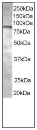 AP08556PU-N - ACAP1 / CENTB1