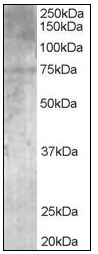AP08561PU-N - MPP5