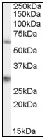 AP08562PU-N - MPP6