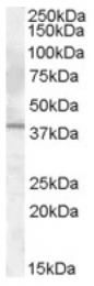 AP16737PU-N - Interleukin-12 beta / IL12B