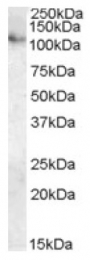 AP16742PU-N - ATP13A1