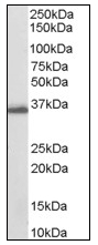 AP08571PU-N - AKR1C3 / DDH3