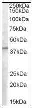 AP08572PU-N - PCID1 / EIF3M