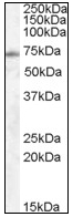 AP08573PU-N - EXOC7