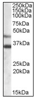 AP08576PU-N - Arylsulfatase B