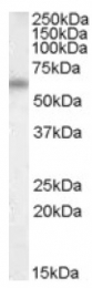 AP16765PU-N - Vitamin D-binding protein