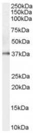 AP16633PU-N - KLK5 / Kallikrein-5