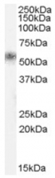 AP16652PU-N - KLK1 / Kallikrein-1
