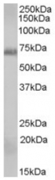 AP16660PU-N - RAD9A