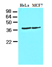 AM09078PU-N - CSNK1A1