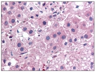 AM06000PU-N - Interleukin-25 / IL25
