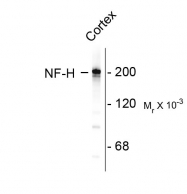 AM08251SU-N - Neurofilament H (200 kD)
