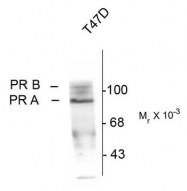 AM08259PU-N - Progesterone receptor
