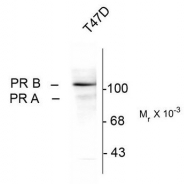 AM08260PU-N - Progesterone receptor