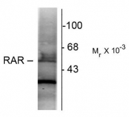 AM08262PU-N - RAR-alpha / RARA