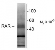 AM08263PU-N - RAR-beta / RARB