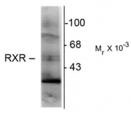 AM08265PU-N - RXR-gamma / RXRG